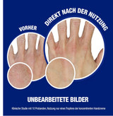 کرم دست سریعالجذب نیتروژنا با گلیسیرین و ویتامین ای Neutrogena Sofort Einziehende Handcreme